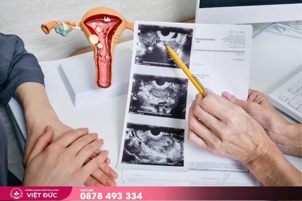 gói khám phụ khoa 2 Gói khám phụ khoa là gì?