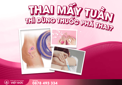 thai mấy tuần dùng thuốc phá thai 2 Thai mấy tuần dùng thuốc phá thai?