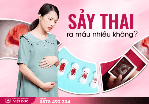 sảy thai 22 Sảy thai ra máu nhiều không?