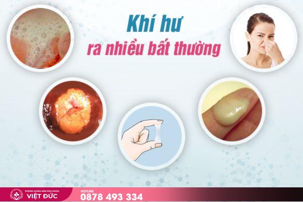 Nữ giới nên thận trọng với bệnh khí hư